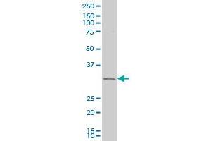 EXOSC2 polyclonal antibody (A01), Lot # ABNOVA060711QCS1 Western Blot analysis of EXOSC2 expression in A-431 . (EXOSC2 antibody  (AA 71-160))