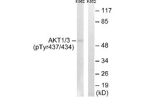 Immunohistochemistry analysis of paraffin-embedded human brain tissue using AKT1/3 (Phospho-Tyr437/434) antibody. (AKT1/3 (pTyr434), (pTyr437) antibody)