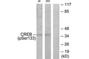 Western blot analysis of extracts from Jurkat and 293 cells treated with UV, using CREB (Phospho-Ser133) Antibody. (CREB1 antibody  (pSer133))