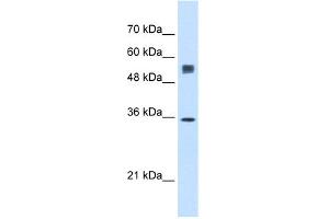 WB Suggested Anti-SSR1 Antibody Titration:  0. (SSR1 antibody  (N-Term))