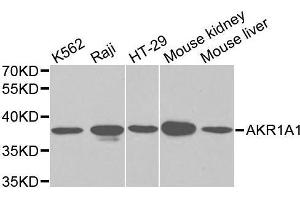 Western blot analysis of Y79 cell and Jurkat cell lysate using AKR1A1 antibody. (AKR1A1 antibody  (AA 1-325))