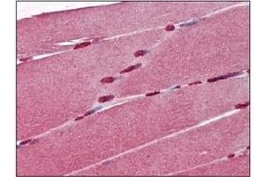 Immunohistochemistry (IHC) image for anti-Cellular Retinoic Acid Binding Protein 1 (CRABP1) (AA 1-137), (N-Term) antibody (ABIN400871) (CRABP1 antibody  (N-Term))