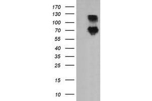 Image no. 3 for anti-Differentially Expressed in FDCP 6 Homolog (DEF6) antibody (ABIN1497809)