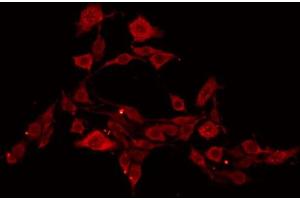 ABIN6269106 staining NIH-3T3 by IF/ICC. (EIF4E antibody  (C-Term))