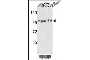 Western blot analysis of ACTN4 Antibody in T47D, A2058, A375, HepG2 cell line and mouse bladder tissue lysates (35ug/lane)