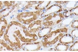 Immunohistochemistry (Paraffin-embedded Sections) (IHC (p)) image for anti-Nucleotide Binding Protein 1 (NUBP1) antibody (ABIN7259122)