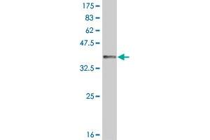 Western Blot detection against Immunogen (36. (IRAK2 antibody  (AA 111-210))