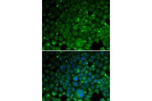 Immunofluorescence analysis of HeLa cells using CRYAA antibody. (CRYAA antibody  (AA 1-173))