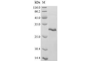 (Tris-Glycine gel) Discontinuous SDS-PAGE (reduced) with 5 % enrichment gel and 15 % separation gel.