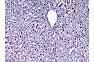 IHC testing of FFPE mouse liver tissue with DJ-1 antibody at 1ug/ml.