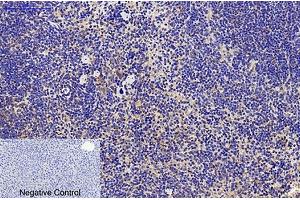 Immunohistochemical analysis of paraffin-embedded mouse liver tissue. (CD68 antibody)
