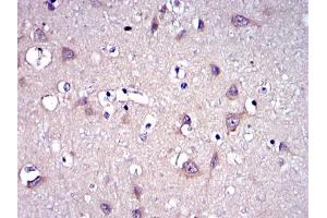 Immunohistochemistry (IHC) image for anti-Matrix Metallopeptidase 9 (Gelatinase B, 92kDa Gelatinase, 92kDa Type IV Collagenase) (MMP9) antibody (ABIN969288)