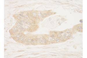 Immunohistochemistry (IHC) image for anti-Ribosomal Protein S6 Kinase, 90kDa, Polypeptide 1 (RPS6KA1) (AA 375-425) antibody (ABIN7449017)