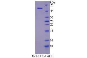 SDS-PAGE analysis of Human MYLK Protein.
