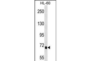 IL1RL2 Antibody (Center) 16964c western blot analysis in HL-60 cell line lysates (35 μg/lane). (IL1RAPL2 antibody  (AA 376-405))