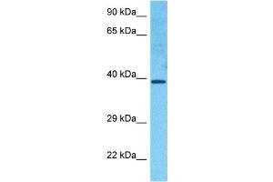 Host:  Rabbit  Target Name:  HOXC11  Sample Tissue:  Human RPMI 8226 Whole Cell  Antibody Dilution:  1ug/ml (HOXC11 antibody  (Middle Region))