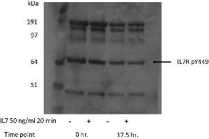 Western Blotting (WB) image for anti-Interleukin 7 Receptor (IL7R) (pTyr449) antibody (ABIN233847) (IL7R antibody  (pTyr449))
