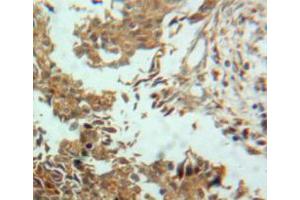Used in DAB staining on fromalin fixed paraffin-embedded ovary tissue (ENPP2 antibody  (AA 637-905))
