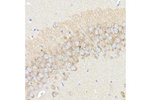 Immunohistochemistry of paraffin-embedded mouse hippocampus using B Rabbit pAb (ABIN6129977, ABIN6137413, ABIN6137415 and ABIN6220894) at dilution of 1:25 (40x lens). (BACE1 antibody  (AA 22-322))