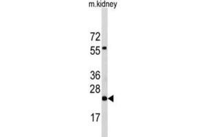 Western Blotting (WB) image for anti-Phosphatidylethanolamine N-Methyltransferase (PEMT) antibody (ABIN2995586) (PEMT antibody)