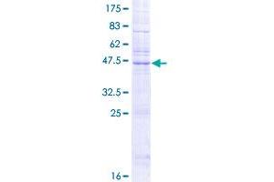 KDELR2 Protein (AA 1-212) (GST tag)