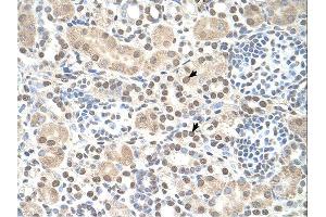 Immunohistochemistry (IHC) image for anti-ST8 alpha-N-Acetyl-Neuraminide alpha-2,8-Sialyltransferase 2 (ST8SIA2) (C-Term) antibody (ABIN2782699) (ST8SIA2 antibody  (C-Term))