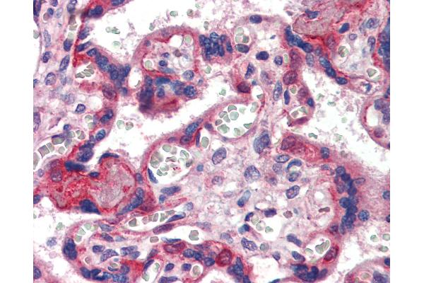 COL6 antibody