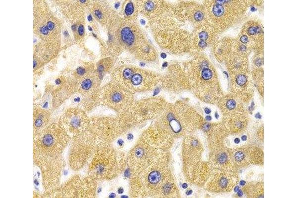 KIF1B antibody