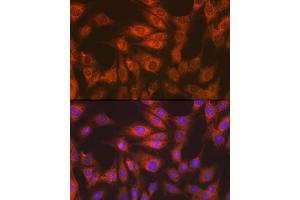 Immunofluorescence (IF) image for anti-Eukaryotic Translation Elongation Factor 2 (EEF2) antibody (ABIN7267025)