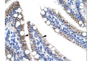 Image no. 1 for anti-Zinc Finger Protein 12 (ZNF12) (AA 73-122) antibody (ABIN202669) (ZNF12 antibody  (AA 73-122))