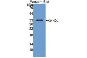 Detection of Recombinant TP53, Human using Polyclonal Antibody to Tumor Protein p53 (P53) (p53 antibody  (AA 108-370))