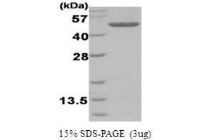 SDS-PAGE (SDS) image for Betaine--Homocysteine S-Methyltransferase (BHMT) protein (His tag) (ABIN666859)
