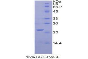 SDS-PAGE (SDS) image for Glucosidase, Alpha, Acid (GAA) (AA 761-919) protein (His tag) (ABIN1877338) (GAA Protein (AA 761-919) (His tag))