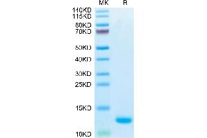 CCL5 Protein (AA 24-91) (His-Avi Tag,Biotin)