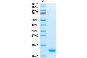 CCL5 Protein (AA 24-91) (His-Avi Tag,Biotin)