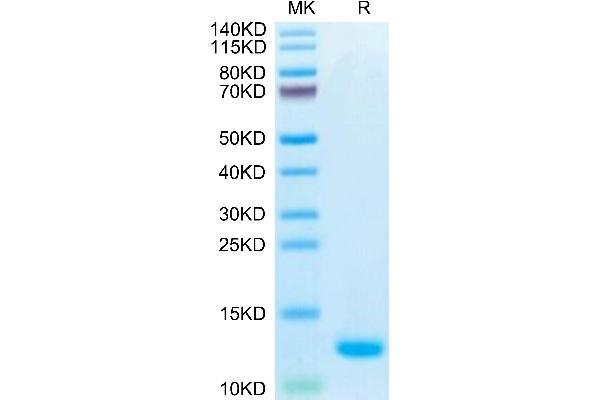 CCL5 Protein (AA 24-91) (His-Avi Tag,Biotin)