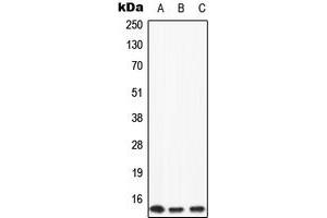 Western blot analysis of Apolipoprotein C2 expression in HeLa (A), mouse liver (B), rat liver (C) whole cell lysates. (Apolipoprotein C-II antibody  (Center))