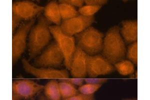 Immunofluorescence analysis of HeLa cells using ZC3H7A Polyclonal Antibody at dilution of 1:100. (ZC3H7A antibody)