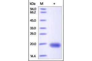 Human VEGF-D, His Tag on SDS-PAGE under reducing (R) condition. (VEGFD Protein (AA 93-201) (His tag))