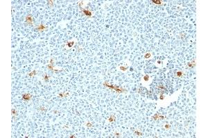 Formalin-fixed, paraffin-embedded human Tonsil stained with Macrophage Monoclonal Antibody (LN-5)