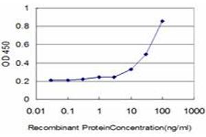 Detection limit for recombinant GST tagged DLD is approximately 1ng/ml as a capture antibody. (DLD antibody  (AA 1-509))