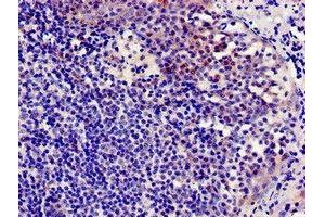 Immunocytochemistry analysis of human tonsil tissue using ABIN7145942 at dilution of 1:100 (CCR7 antibody  (AA 332-378))