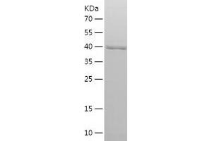 Western Blotting (WB) image for Formiminotransferase Cyclodeaminase (FTCD) (AA 327-541) protein (His-IF2DI Tag) (ABIN7284016) (FTCD Protein (AA 327-541) (His-IF2DI Tag))