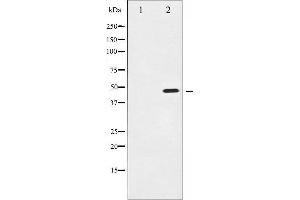 Western Blotting (WB) image for anti-Inhibitor of kappa Light Polypeptide Gene Enhancer in B-Cells, Kinase gamma (IKBKG) (N-Term) antibody (ABIN6262516)