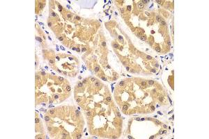 Immunohistochemistry of paraffin-embedded human kidney using PRKAG3 antibody (ABIN5975719) at dilution of 1/100 (40x lens). (PRKAG3 antibody)