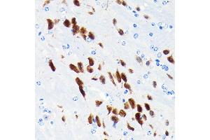 Immunohistochemistry of paraffin-embedded mouse brain using NeuN Rabbit mAb (ABIN7270098) at dilution of 1:100 (40x lens). (NeuN antibody)