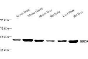 Western blot analysis of BRD9 (ABIN7073233),at dilution of 1: 1500