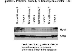 Image no. 1 for anti-Hes Family bHLH Transcription Factor 1 (HES1) (C-Term) antibody (ABIN347373) (HES1 antibody  (C-Term))