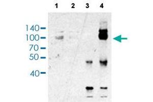 Immunoprecipitation analysis of Lane 1: 5% Input, Lane 2: 5% Sup, Lane 3: Normal IgG, and Lane 4: HNRNPUL1 ppt. (HNRNPUL1 antibody  (AA 807-856))