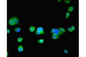 Immunofluorescent analysis of MCF-7 cells using ABIN7173722 at dilution of 1:100 and Alexa Fluor 488-congugated AffiniPure Goat Anti-Rabbit IgG(H+L) (TPPP2 antibody  (AA 1-170))